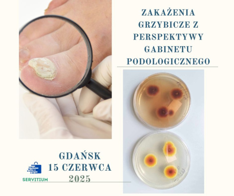 Szkolenie-Zakażenia grzybicze z perspektywy gabinetu podologicznego. Szkolenie-Zakażenia grzybicze z perspektywy gabinetu podologicznego.